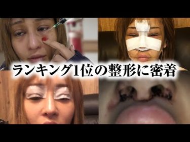 【密着】2020年上半期１番流行った整形手術 by 桜井野の花TV